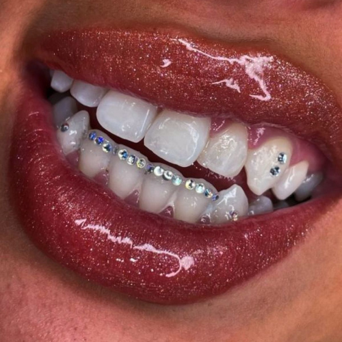 Formation Strass Dentaire